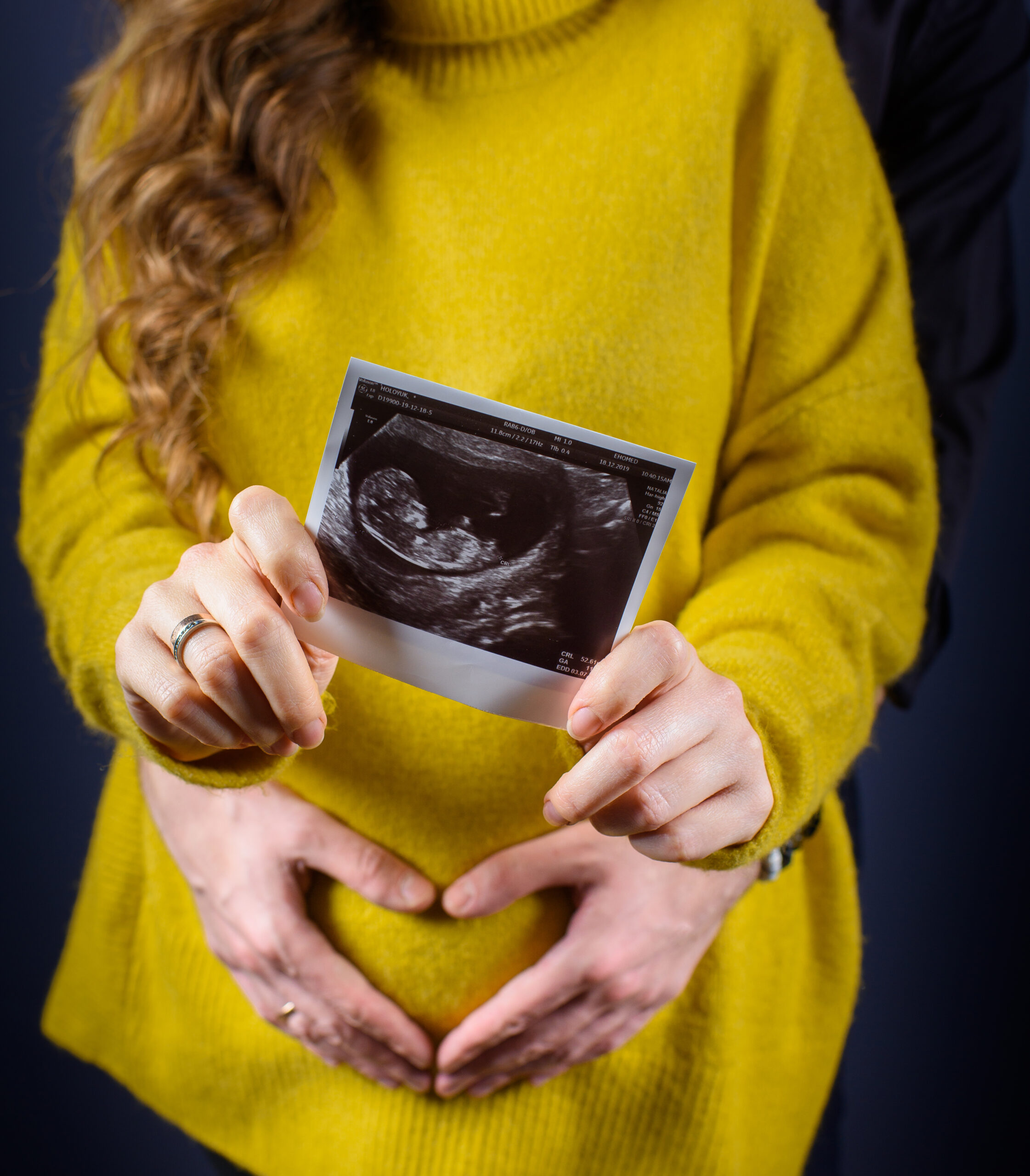 Ecografía de Control Prenatal
