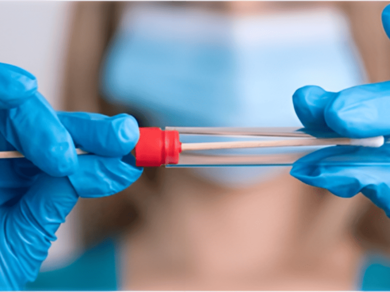 Prueba cobas HPV