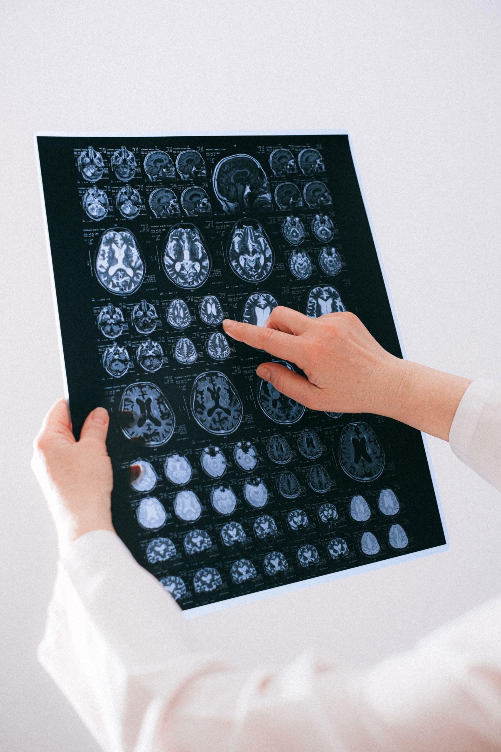 Neurología