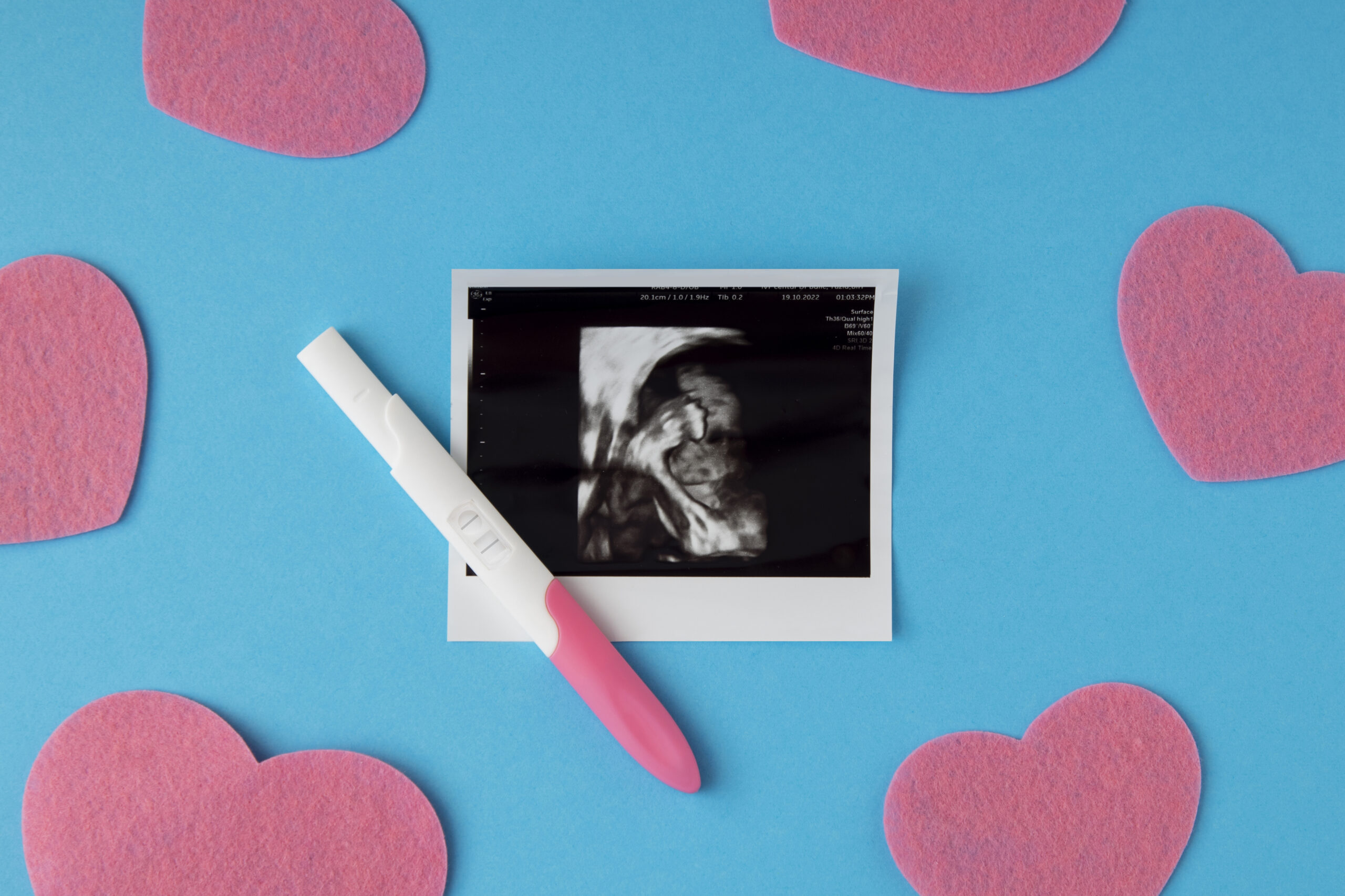 Ecografía de Fertilidad